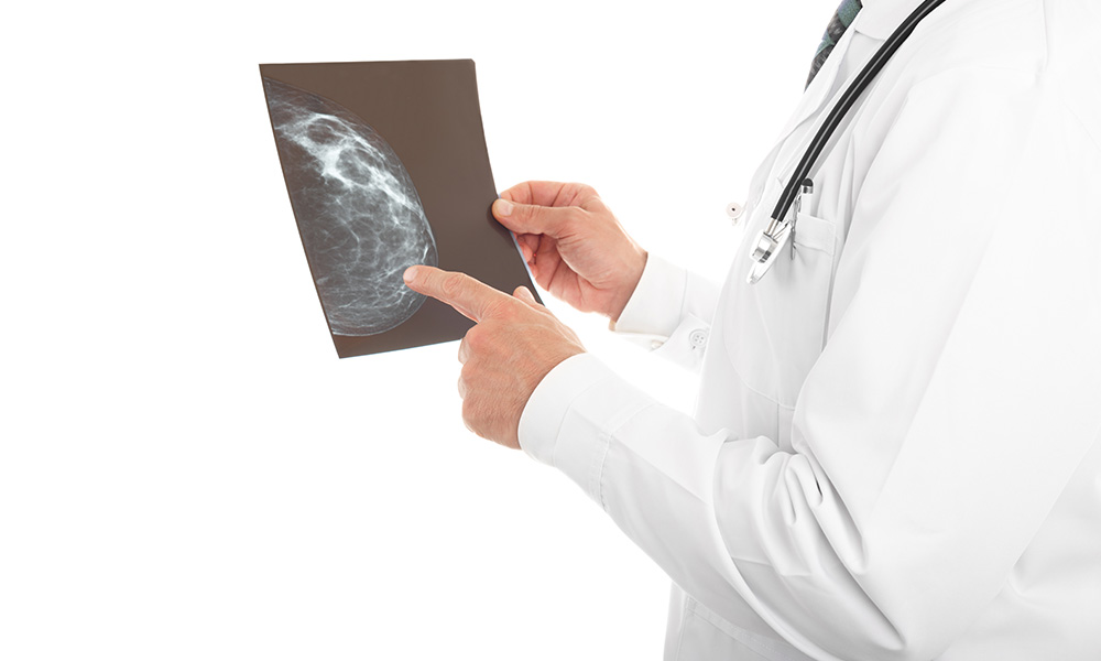 Doctor looking at a mammography
