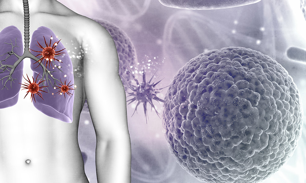3D medical background showing virus cells in male figures lungs